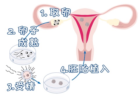 靠谱试管代孕机构生殖医学中心